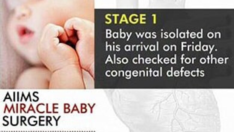 Efforts go in vain, baby with protruding heart dies