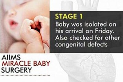 Efforts go in vain, baby with protruding heart dies