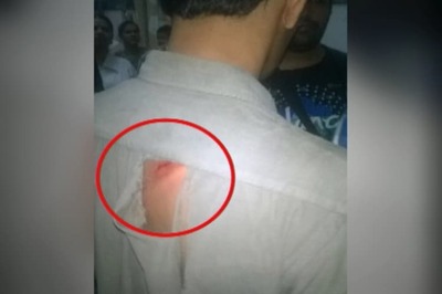 Mumbai: KEM doctors beaten up after child dies of dengue, over 1200 doctors on strike