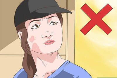 How to Get Rid of Sunburn Fast