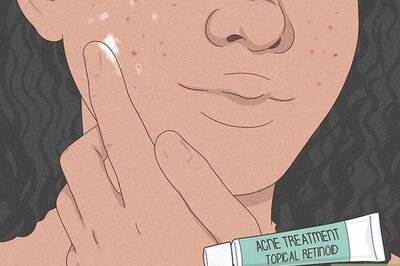 How to Get Rid of a Pimple with No Head