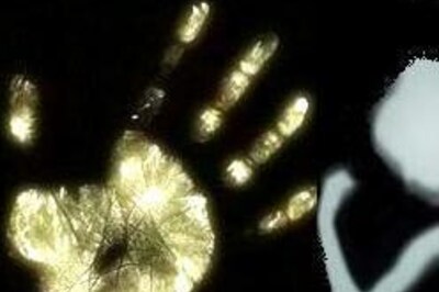 Love song provokes woman to set herself ablaze