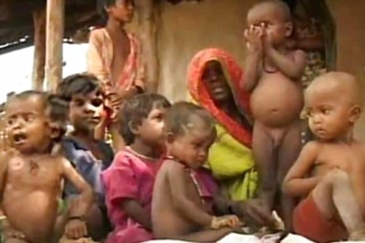 India has 40 per cent of world's malnourished: Expert