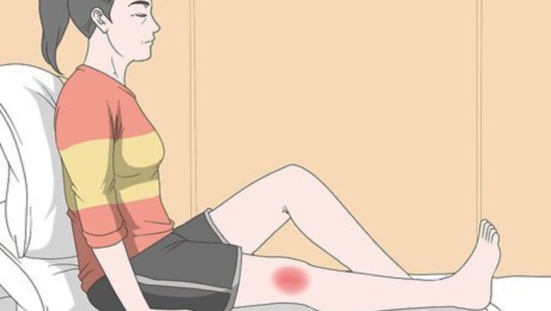 How to Improve Lymphatic Drainage in the Legs