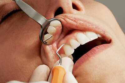 Importance Of Regular Dental Checkups In Catching Problems Early