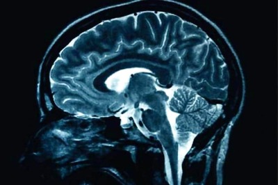 Here's Why Some People Are More Intelligent Than Others