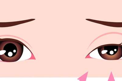 What Is Ptosis? What Causes It And What Its Symptoms Are