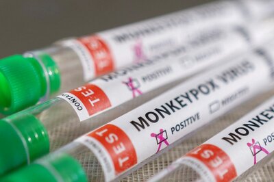 Monkeypox: Health Ministry Releases Dos and Don'ts to Prevent Spread