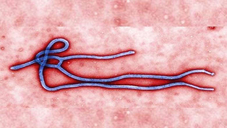 US doctor with Ebola in Atlanta for treatment