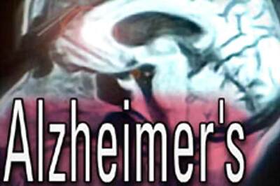 Key molecule behind Alzheimer's disease identified