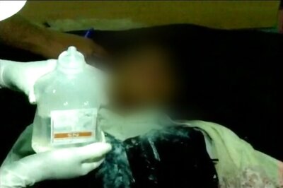 Acid Attack on Girl in Madhya Pradesh's Agar Malwa district, Boy Still At Large