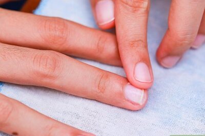 How to Prevent Hangnails
