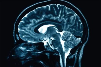 Stress hormone tied to short-term memory loss as we age