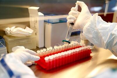 Maharashtra Minister Dilip Walse-Patil Tests Positive for Covid-19