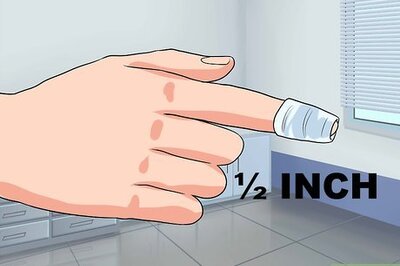 How to Treat an Ingrown Fingernail