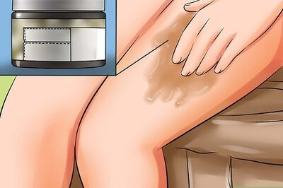 How to Cover Up Stretch Marks on Legs