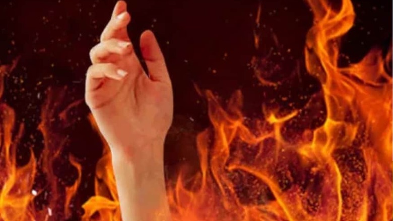 21-year-old Odisha Woman Set on Fire for Failing to Bring Dowry, In-laws Arrested