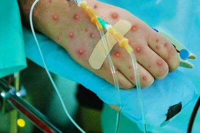 Paediatric Monkeypox Cases Rising in the US as More Than 30 Children Infected