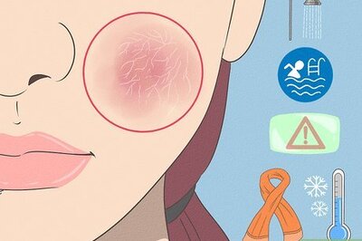 How to Heal Cracked Skin on the Face