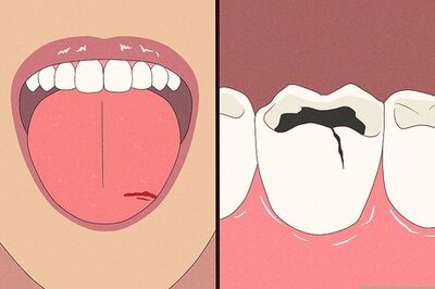 How to Treat a Fat Lip