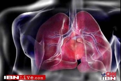 India to lose over $4.58 trillion to non-communicable diseases