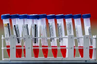 How to Perform Covid-19 Rapid Antigen Test at Home and What to Avoid?