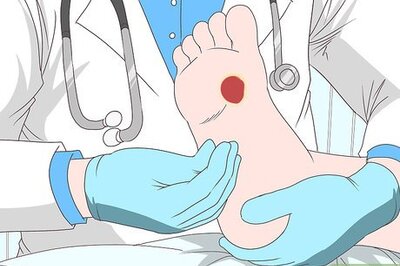 How to Heal Foot Ulcers