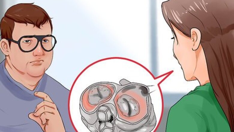 How to Find the Cause of Aortic Regurgitation