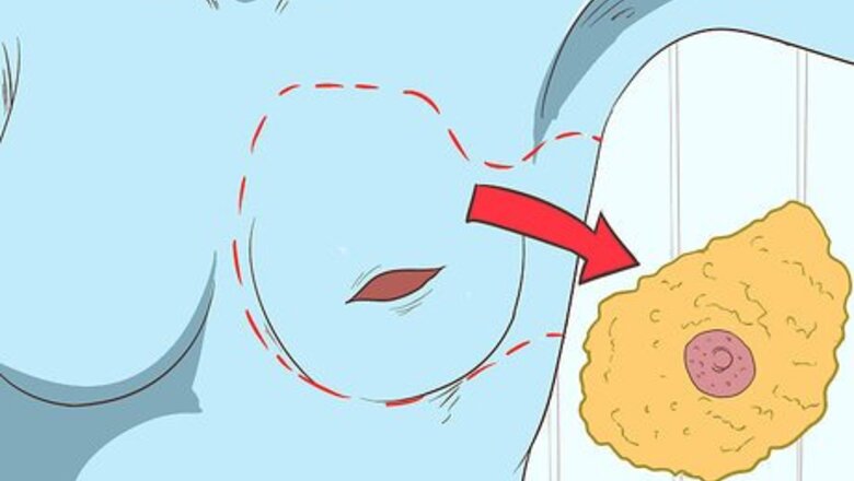How to Treat Breast and Extramammary Paget's Disease