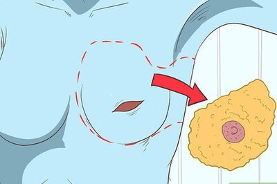 How to Treat Breast and Extramammary Paget's Disease