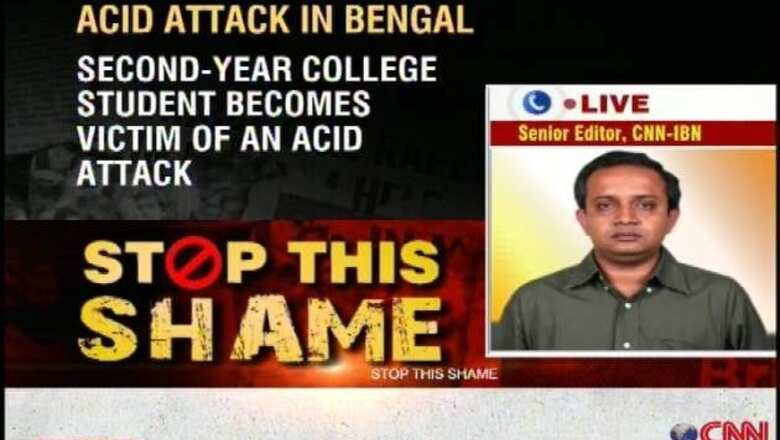 WB: 2nd year college student attacked with acid in Burdwan