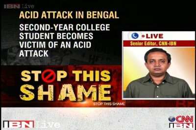 WB: 2nd year college student attacked with acid in Burdwan