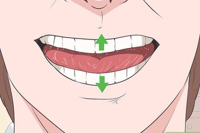 How to Stop TMJ Clicking