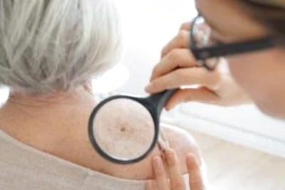 Major Symptoms And Causes That Could Be Indicative Of Skin Cancer