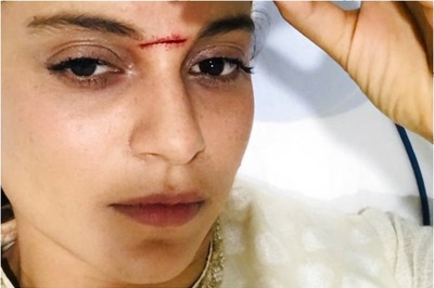 Kangana Ranaut is Proud of This Sword Injury on Her Forehead Sustained During Manikarnika Shoot