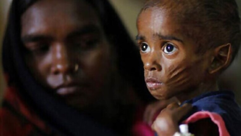 Rewards for health workers spotting malnourished kids