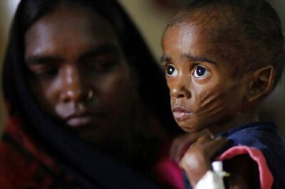 Rewards for health workers spotting malnourished kids