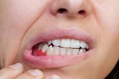 Regular Dental Check-ups To Staying Hydrated, 10 Simple Practices For Healthy Gums