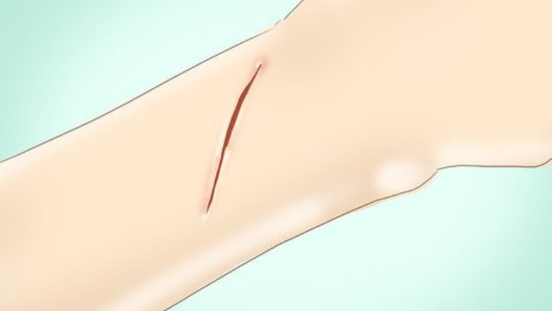 How to Clean a Wound