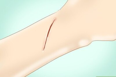 How to Clean a Wound