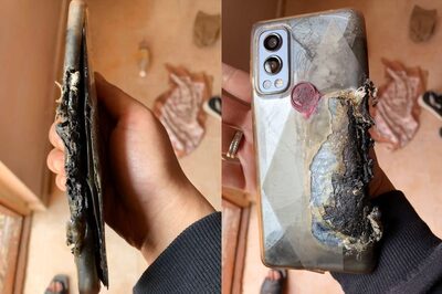 OnePlus Nord 2 5G Explodes: User Who Suffered Severe Burns To Get Refund; Free Medical Care: Report