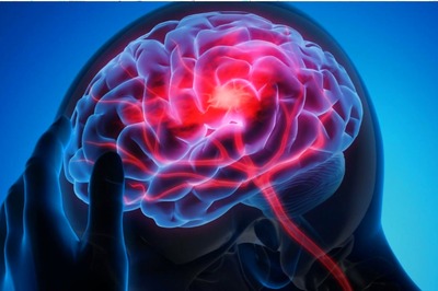 Purple Day 2022: Know about the Causes, Symptoms and Treatment for Epilepsy