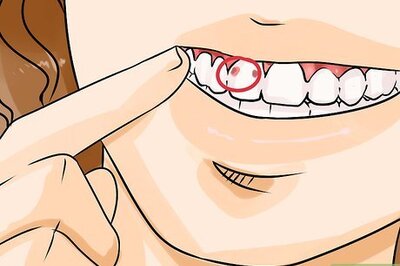 How to Know if You Have a Cavity