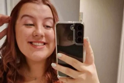 21-year-old Woman, Allergic To Water, Says 'People Always Ask The Same Question'