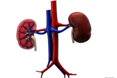 Can kidney stones be managed conservatively?