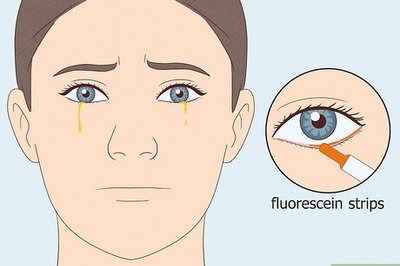 What Causes Yellow Tears? The Viral TikTok Video Explained