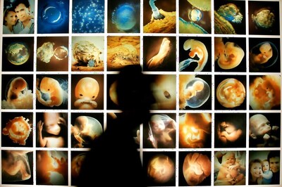 Men More Prone To Infertility Due To Less Sleep: Experts