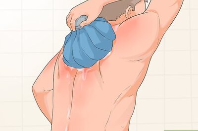 How to Turn Sunburn Into a Tan