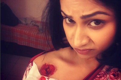 'Roadies 8' Winner Aanchal Khurana Hospitalised