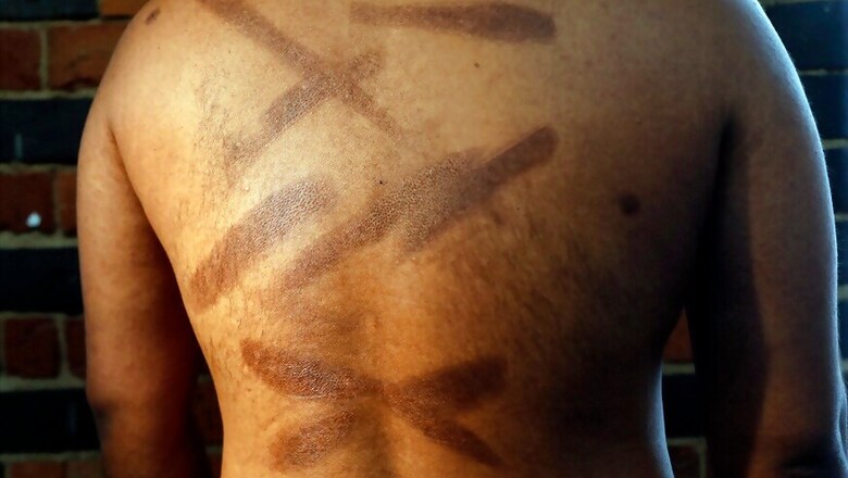 Sri Lanka Government Faces Pressure Over Torture, Rape Allegations